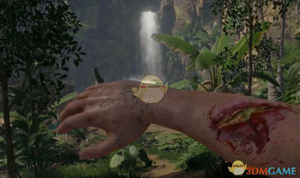 《绿色地狱》被蛇咬了怎么办 伤口化脓处理方法介绍